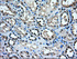 Anti-TACC3 Mouse Monoclonal Antibody [clone: OTI7B11]