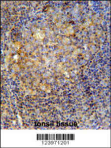 Anti-MME Rabbit Polyclonal Antibody (HRP (Horseradish Peroxidase))