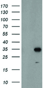 Anti-MLF1 Mouse Monoclonal Antibody [clone: OTI2H10]