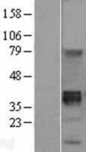 Anti-TNFRSF11A Rabbit Polyclonal Antibody