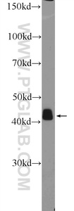 Anti-ACTA1 Rabbit Polyclonal Antibody