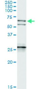 Anti-NEFL Polyclonal Antibody Pair
