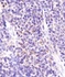 Anti-Aggrecan Neoepitope Rabbit Polyclonal Antibody (HRP (Horseradish Peroxidase))