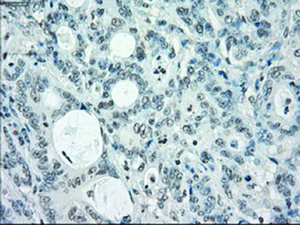 Anti-SLC7A8 Mouse Monoclonal Antibody [clone: OTI7D6]