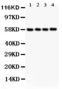 Anti-PKM Rabbit Polyclonal Antibody