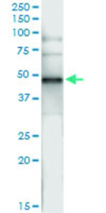 Anti-CNP Polyclonal Antibody Pair