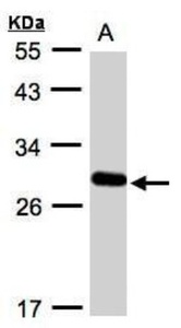 Anti-BIRC5 Rabbit Polyclonal Antibody