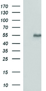 Anti-MMP13 Mouse Monoclonal Antibody [clone: OTI3F5]