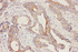 Anti-Fatty Acid Binding Protein 5 Rabbit Polyclonal Antibody