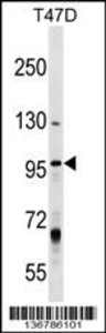 Anti-MCM8 Rabbit Polyclonal Antibody (AP (Alkaline Phosphatase))