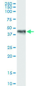 Anti-HOXA1 Polyclonal Antibody Pair