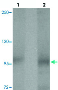 Anti-PTCHD2 Rabbit Polyclonal Antibody
