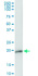 Anti-CLDN1 Polyclonal Antibody Pair