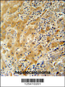 Anti-NUSAP Rabbit Polyclonal Antibody (AP (Alkaline Phosphatase))