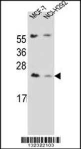 Anti-LIN7C Rabbit Polyclonal Antibody (HRP (Horseradish Peroxidase))