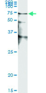 Anti-STK38 Antibody Pair