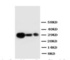 Anti-TIMP1 Rabbit Polyclonal Antibody