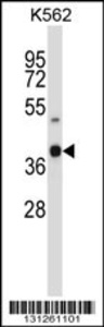 Anti-OR52H1 Rabbit Polyclonal Antibody (Biotin)