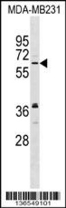 Anti-NSMF Rabbit Polyclonal Antibody (PE (Phycoerythrin))