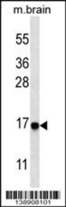 Anti-MAP1LC3A Rabbit Polyclonal Antibody (Biotin)