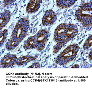 Anti-CCK4 Rabbit Polyclonal Antibody