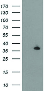 Anti-ERCC1 Mouse Monoclonal Antibody [clone: OTI3E1]