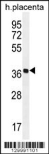 Anti-OR5AS1 Rabbit Polyclonal Antibody (PE (Phycoerythrin))