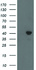 Anti-ACAT2 Mouse Monoclonal Antibody [clone: OTI7B1]