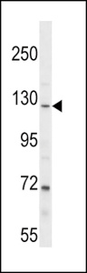 Anti-PARG Rabbit Polyclonal Antibody (AP (Alkaline Phosphatase))