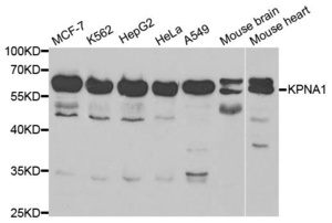 Western blot analysis of extracts of various cell lines using KPNA1 antibody