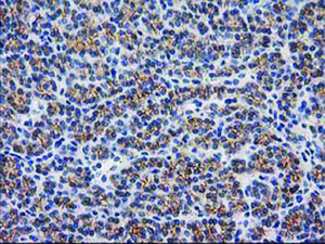 Anti-CTNNB1 Mouse Monoclonal Antibody [clone: OTI6A3]