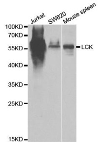 Western blot analysis of extracts of various cell lines using LCK antibody