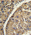 Anti-VTN Rabbit Polyclonal Antibody