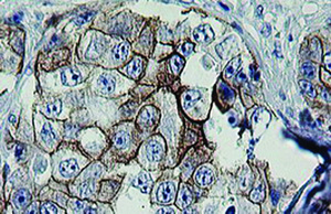 Anti-ERBB2 Mouse Monoclonal Antibody [clone: OTI4G7]