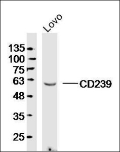 Western blot analysis of human Lovo lysates (Lane 1) using CD239 antibody.