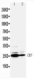 Anti-C Reactive Protein Rabbit Polyclonal Antibody