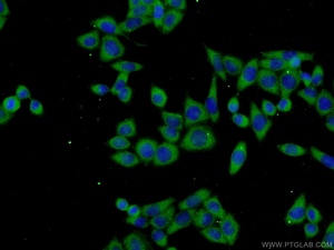 Anti-TPTE2 Rabbit Polyclonal Antibody