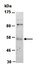 Western blot analysis of total cell extracts from human Jurkat using ETV6 antibody