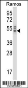 Anti-NCK2 Rabbit Polyclonal Antibody (HRP (Horseradish Peroxidase))
