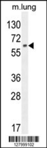 Anti-NFE2L1 Rabbit Polyclonal Antibody (HRP (Horseradish Peroxidase))