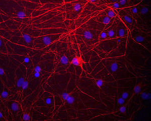 View of mixed neuron/glial cultures stained with Chicken polyclonal antibody to Neurofilament Medium BSENC-1393-50 (red). The Neurofilament Medium (NF-M) protein is assembled into neurofilaments which are found throughout the axons, dendrites and perikarya of these cells.