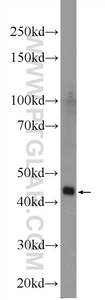 Anti-ZDHHC13 Rabbit Polyclonal Antibody