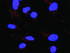 Anti-GSTP1 + TRAF2 Antibody Pair