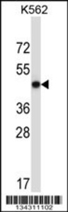 Anti-METAP2 Rabbit Polyclonal Antibody (Biotin)