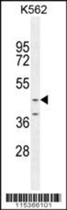 Anti-OC90 Rabbit Polyclonal Antibody (AP (Alkaline Phosphatase))