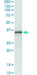 Anti-MSX1 Antibody Pair
