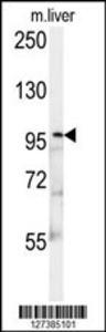 Anti-KIF9 Rabbit Polyclonal Antibody (HRP (Horseradish Peroxidase))