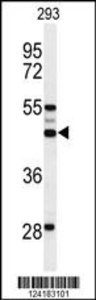 Anti-SLC51A Rabbit Polyclonal Antibody (HRP (Horseradish Peroxidase))