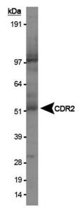 Anti-CDKN2A Rabbit Polyclonal Antibody (DyLight® 550)