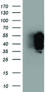 Anti-TFG Mouse Monoclonal Antibody [clone: OTI2C3]